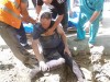 Житель Симферополя со сломанной ногой 16 часов просидел в бетонной ловушке, созданной дорожными службами