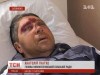 На дискотеке под Запорожьем избили мэра