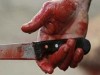В Крыму мужчина из-за ревности полоснул подругу ножом по шее