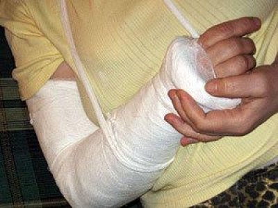 Милиция Крыма проверяет сотрудников, сломавших руку человеку